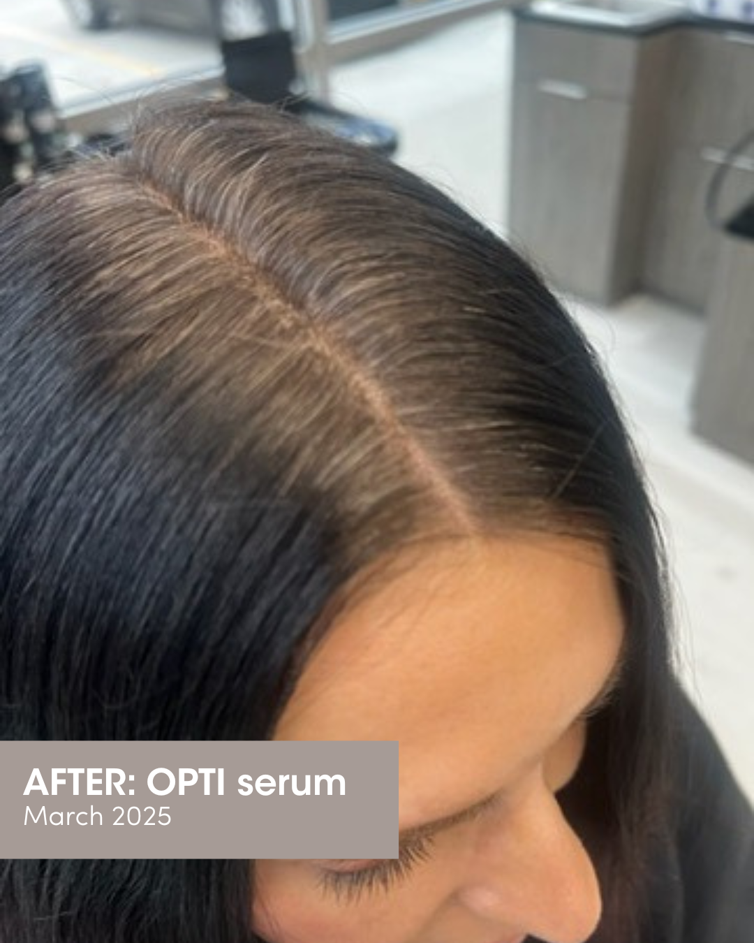 OPTI Hair Growth and Grey Prevention set
