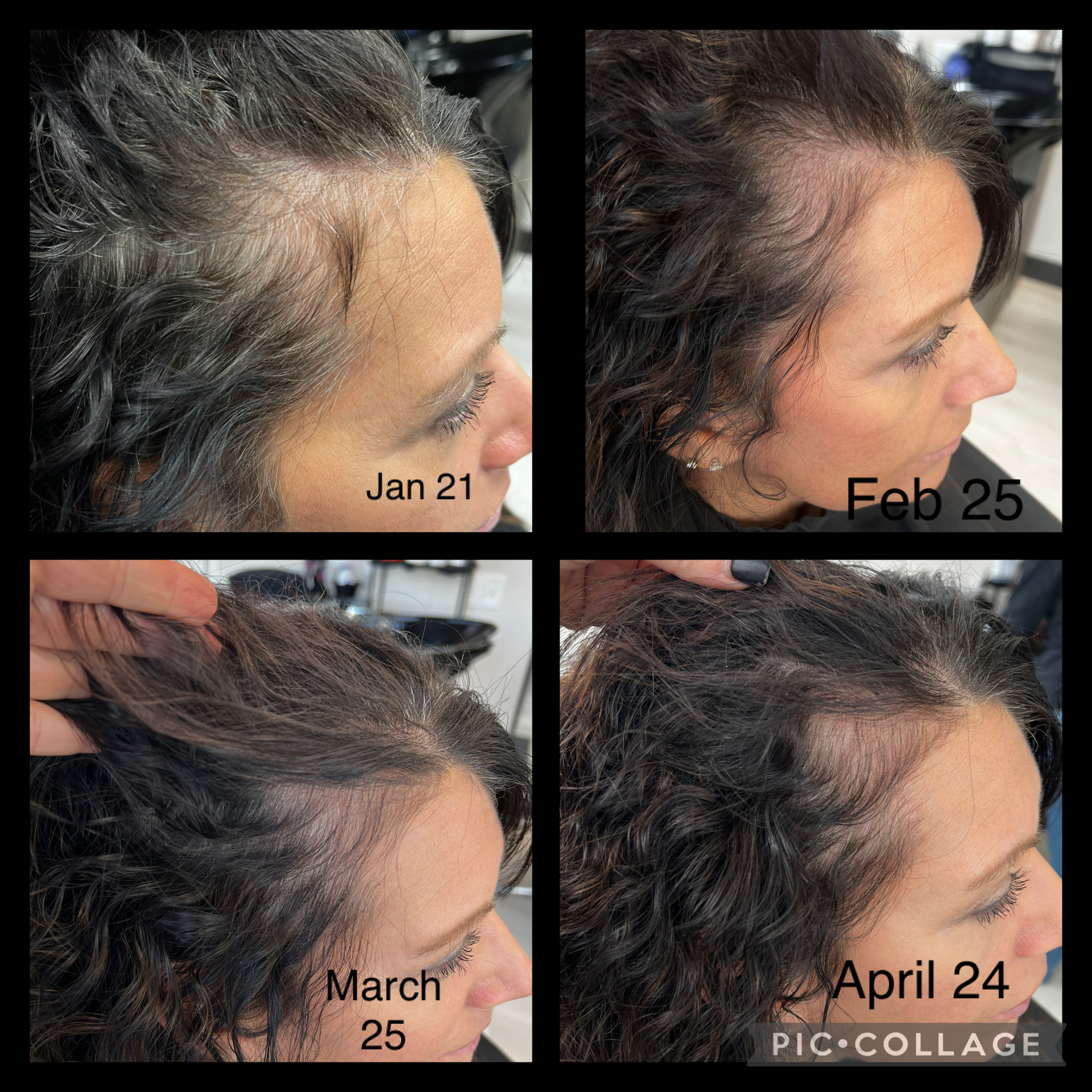 OPTI Hair Growth and Grey Prevention System