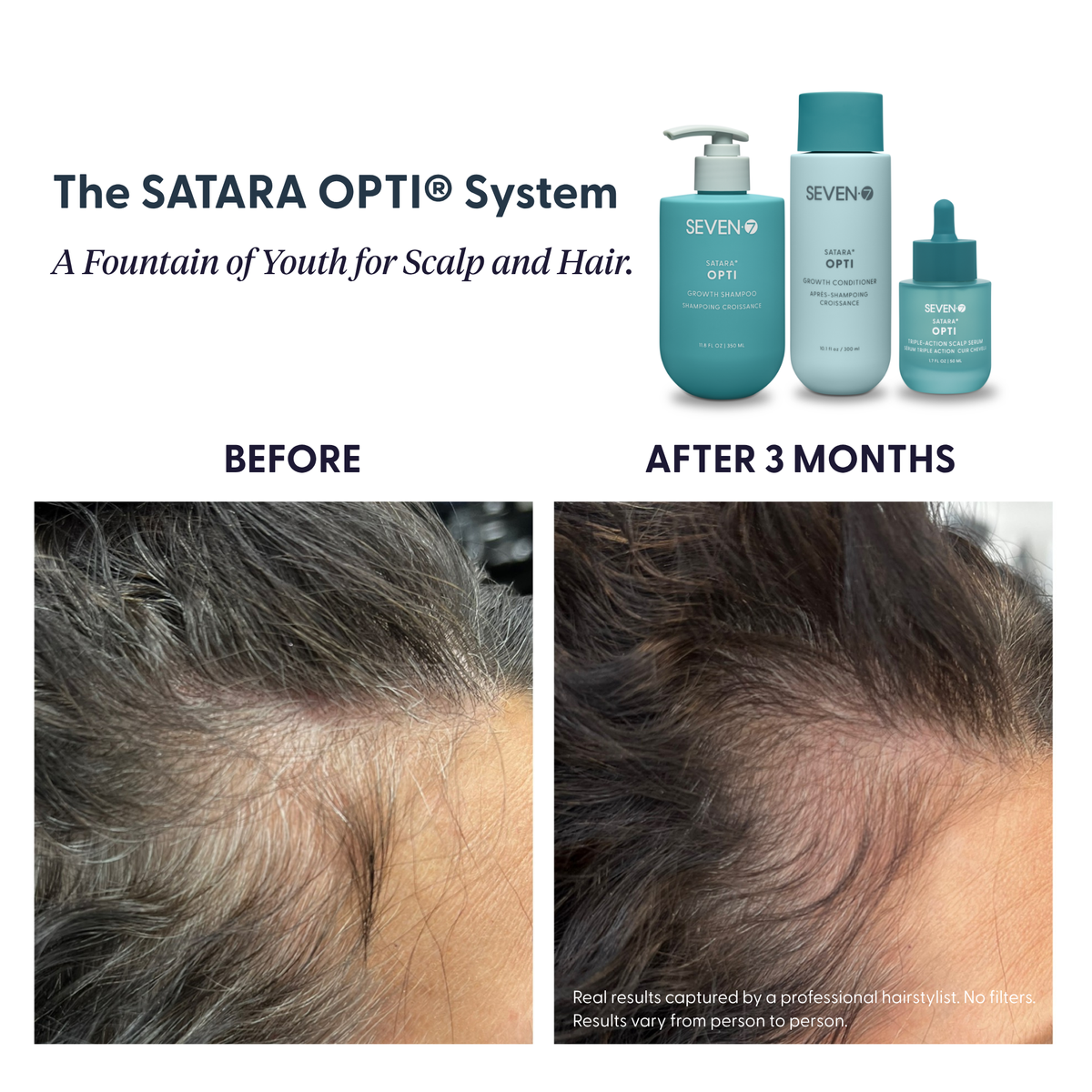 OPTI Triple-Action Scalp Serum