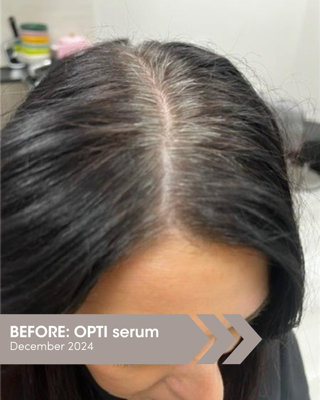 OPTI Hair Growth and Grey Prevention set