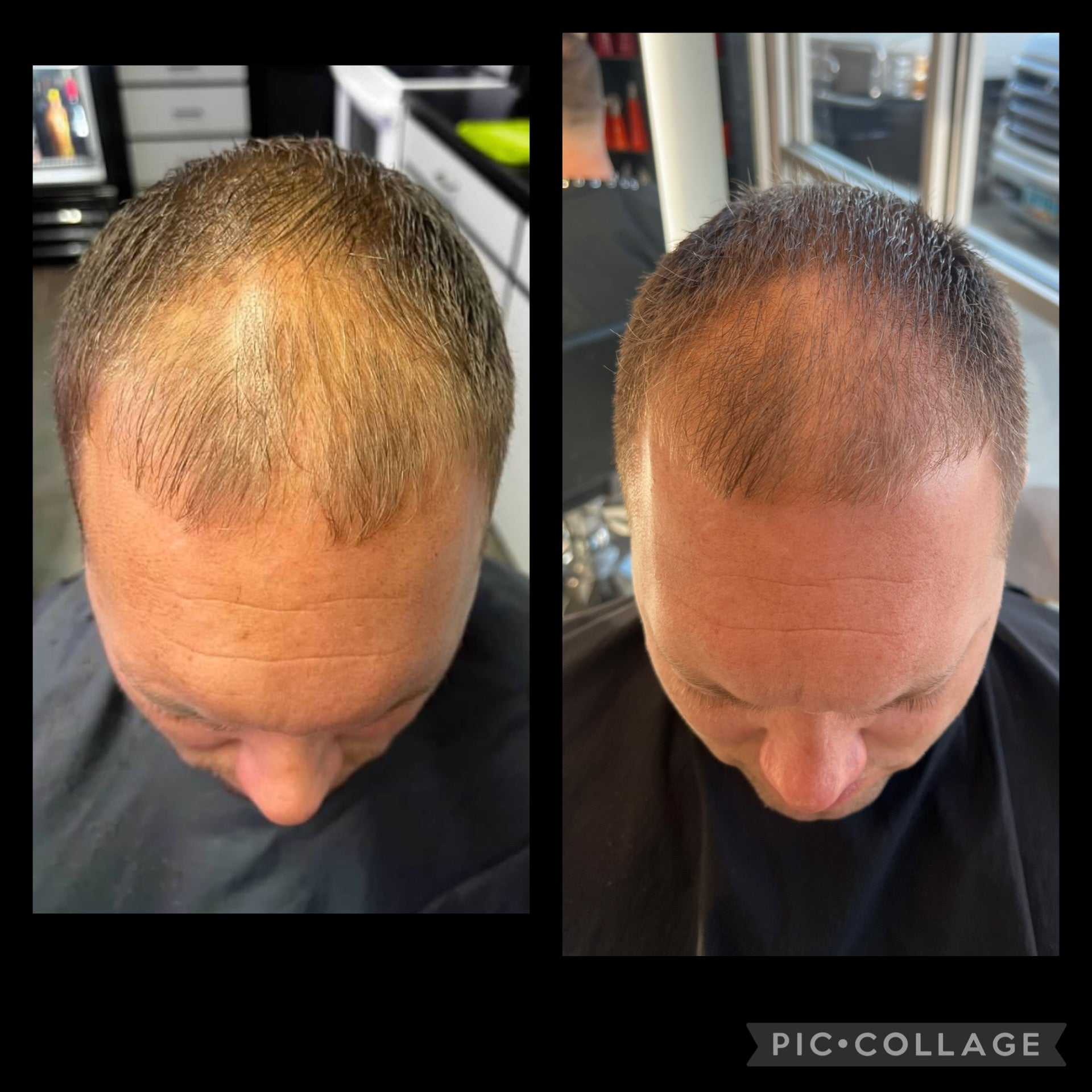 OPTI Hair Growth and Grey Prevention System